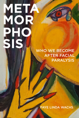 Metamorphosis: Who We Become After Facial Paralysis - Wachs, Faye Linda