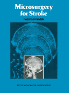 Microsurgery for Stroke