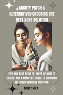 Mighty Patch & Alternatives: Choosing the Best Acne Solution: Tips for Best Results, Types of Acne It Treats, and a Complete Guide to Choosing the Right Skincare Solution