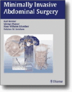 Minimally Invasive Abdominal Surgery - Platzer, Werner (Editor), and Schreiber, Hans Wilhelm, and Kremer, Karl (Editor)