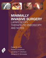 Minimally Invasive Surgery: Laparoscopy, Therapeutic Endoscopy and Notes