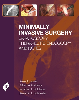 Minimally Invasive Surgery: Laparoscopy, Therapeutic Endoscopy and NOTES - Jones, Daniel  B, and Andrews, Robert, and Critchlow, Jonathan F