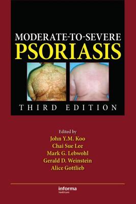 Moderate-To-Severe Psoriasis, Third Edition - Lee, Chai Sue (Editor), and Lebwohl, Mark G (Editor), and Weinstein, Gerald (Editor)