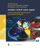 Modern Mitral Valve Repair: Echocardiographic Interpretations and Surgical Strategies