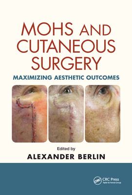 Mohs and Cutaneous Surgery: Maximizing Aesthetic Outcomes - Berlin, Alexander (Editor)