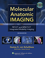 Molecular Anatomic Imaging: Pet-CT and Spect-CT Integrated Modality Imaging