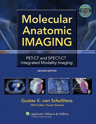 Molecular Anatomic Imaging: Pet-CT and Spect-CT Integrated Modality Imaging - Von Schulthess, Gustav K, MD, PhD (Editor)