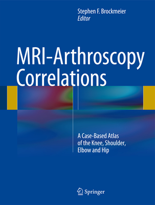 MRI-Arthroscopy Correlations: A Case-Based Atlas of the Knee, Shoulder, Elbow and Hip - Brockmeier, Stephen F. (Editor)