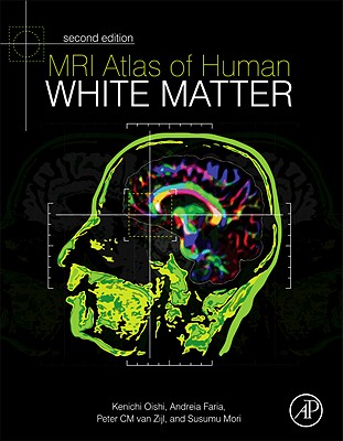 MRI Atlas of Human White Matter - Oishi, Kenichi, and Faria, Andreia V., and van Zijl, Peter C M