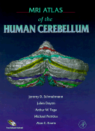 MRI Atlas of the Human Cerebellum