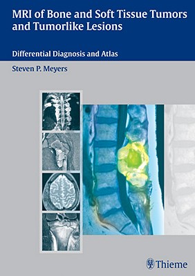 MRI of Bone and Soft Tissue Tumors and Tumorlike Lesions: Differential Diagnosis and Atlas - Meyers, Steven P