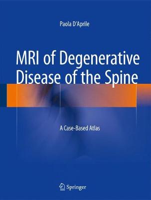 MRI of Degenerative Disease of the Spine: A Case-Based Atlas - D'Aprile, Paola