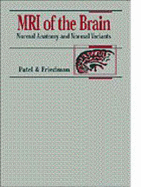 MRI of the Brain: Normal Anatomy and Normal Variants