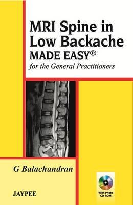 MRI Spine in Low Backache Made Easy - Balachandran, G