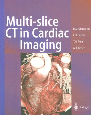 Multi-Slice CT in Cardiac Imaging: Technical Principles, Clinical Application and Future Developments - Ohnesorge, Bernd M, and Becker, Christoph R, and Flohr, Thomas G