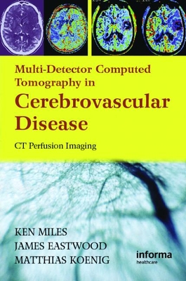 Multidetector Computed Tomography in Cerebrovascular Disease: CT Perfusion Imaging - Miles, Kenneth (Editor), and Eastwood, James D, MD (Editor), and Konig, Matthias (Editor)