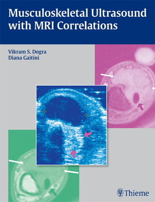 Musculoskeletal Ultrasound with MRI Correlations - Dogra, Vikram S (Editor), and Gaitini, Diana (Editor)