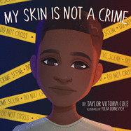 My Skin Is Not A Crime