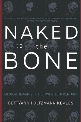 Naked to the Bone: Medical Imaging in the Twentieth Century - Kevles, Bettyann Holtzmann