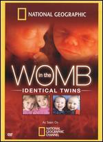 National Geographic: In the Womb - Identical Twins