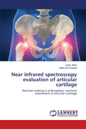 Near Infrared Spectroscopy Evaluation of Articular Cartilage