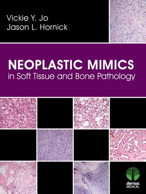 Neoplastic Mimics in Soft Tissue and Bone Pathology - Jo, Vickie Y., and Hornick, Jason L.