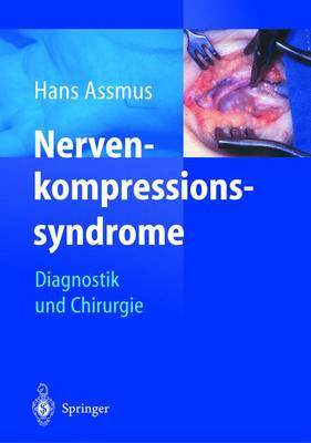 Nervenkompressionssyndrome: Diagnostik Und Chirurgie - Assmus, Hans, and "Ekz ""Am Petrus""", and Einkaufszenrum Ekz Am Petrus