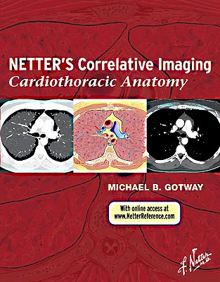 Netter's Correlative Imaging: Cardiothoracic Anatomy - Gotway, Michael B, MD, and Major, Nancy M, MD (Editor)