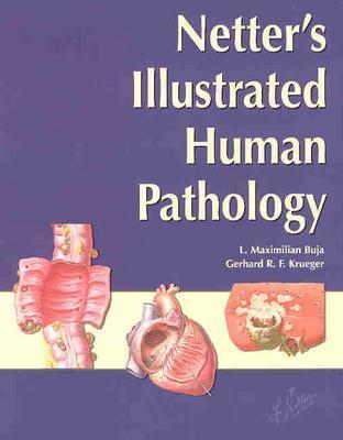 Netter's Illustrated Human Pathology - Buja, L Maximilian, and Krueger, Gerhard R F, MD, PhD