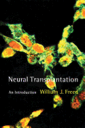 Neural Transplantation: An Introduction