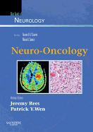Neuro-Oncology: Blue Books of Neurology Series