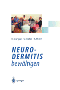 Neurodermitis Bewaltigen: Verhaltenstherapie Dermatologische Schulung Autogenes Training