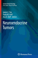 Neuroendocrine Tumors