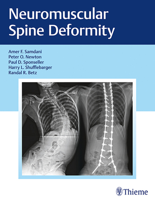 Neuromuscular Spine Deformity - Samdani, Amer F (Editor), and Newton, Peter O (Editor), and Sponseller, Paul D (Editor)