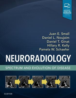Neuroradiology: Spectrum and Evolution of Disease - Small, Juan E, MD, Msc, and Noujaim, Daniel L, MD, and Ginat, Daniel T, MD, MS