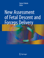 New Assessment of Fetal Descent and Forceps Delivery