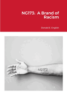 Ng173: A Brand of Racism
