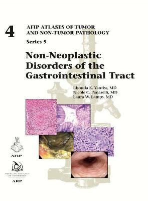 Non-Neoplastic Disorders of the Gastrointestinal Tract - Yantiss, Rhonda K., and Panarelli, Nicole C., and Lamps, Laura W.