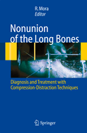 Nonunion of the Long Bones: Diagnosis and Treatment with Compression-Distraction Techniques