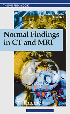 Normal Findings in CT and MRI - Moeller, Torsten B, and Reif, Emil