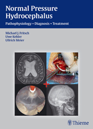 Normal Pressure Hydrocephalus: Pathophysiology - Diagnosis - Treatment