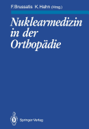 Nuklearmedizin in Der Orthopdie