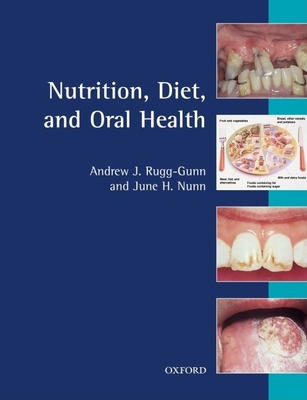 Nutrition, Diet and Oral Health - Rugg-Gunn, Andrew J, and Nunn, June