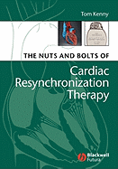 Nuts and Bolts of Cardiac