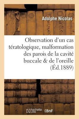 Observation d'Un Cas T?ratologique Rare: Malformation Des Parois de la Cavit? Buccale: Et de l'Oreille Moyenne - Nicolas, Adolphe