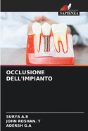 Occlusione Dell'impianto