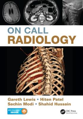On Call Radiology - Lewis, Gareth, and Modi, Sachin, and Patel, Hiten