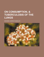 On Consumption, and Tuberculosis of the Lungs