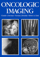 Oncologic Imaging: A Clinical Perspective