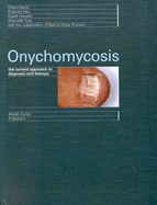 Onychomycosis: The Current Approach to Diagnosis and Therapy - Baran, Robert, MD, and Haneke, Ekart, and Hay, Roderick J